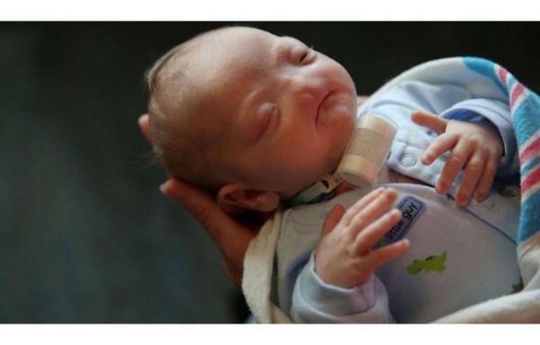 Milagroso, no tiene nariz