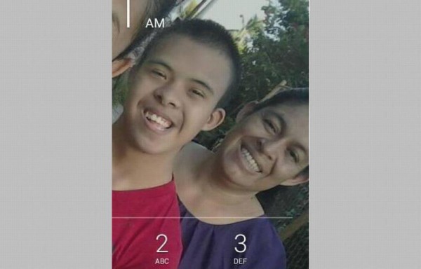 Murió por quemaduras tras incendio en su casa