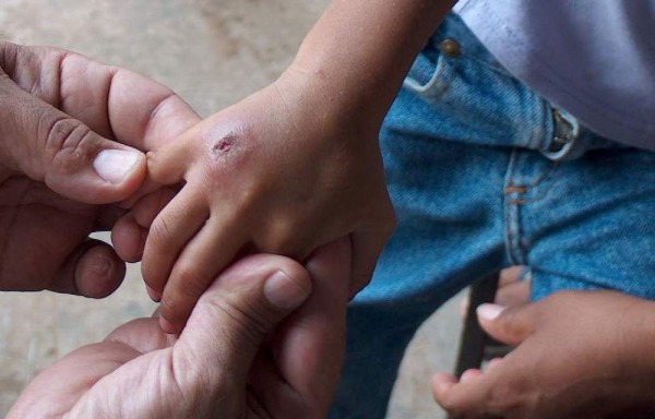 La atención es importante para minimizar riesgos.