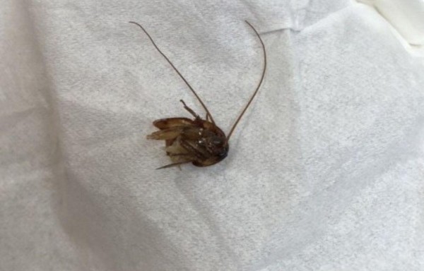 Vivió con una cucaracha en su oído por una semana