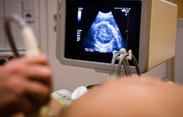 Mujer con dos úteros tuvo tres hijos en un mes