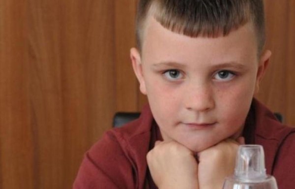 Un niño es alérgico a su propio pelo