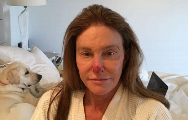 Se operó de Cáncer