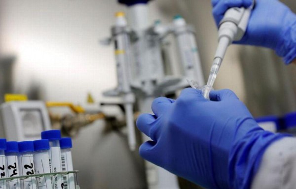 El Gorgas confirmó los casos de viruela.