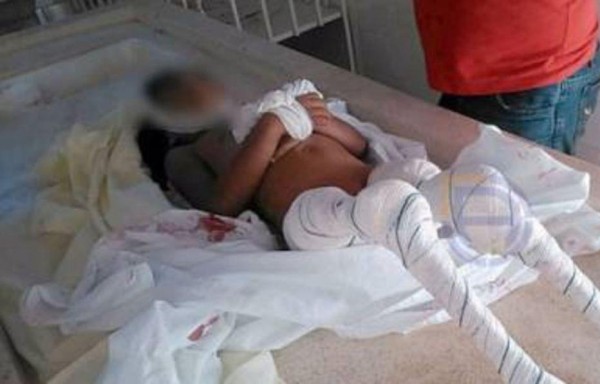 Niña de 6 años fue devorada por las pirañas