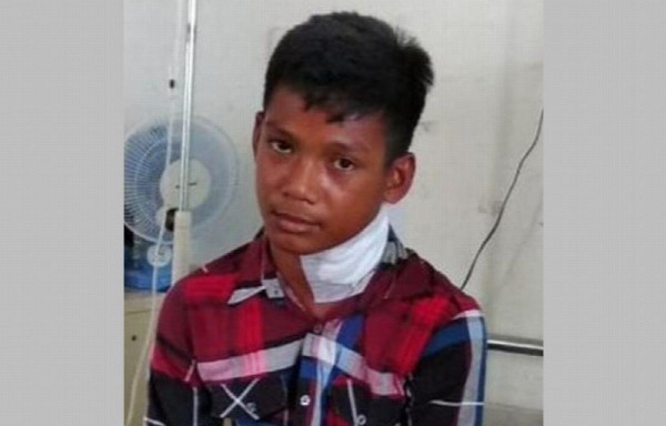 Un pez espada atravesó su cuello y el chico sobrevivió