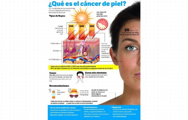 Detectaron 2 mil 182 casos de cáncer de piel en ocho años