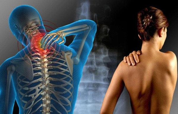 ¿Qué es la esclerosis?