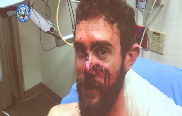 Mató un puma con sus manos