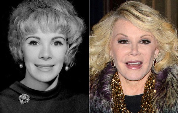 Joan Rivers.