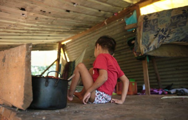 Euri no camina y debe arrastrarse para movilizarse.