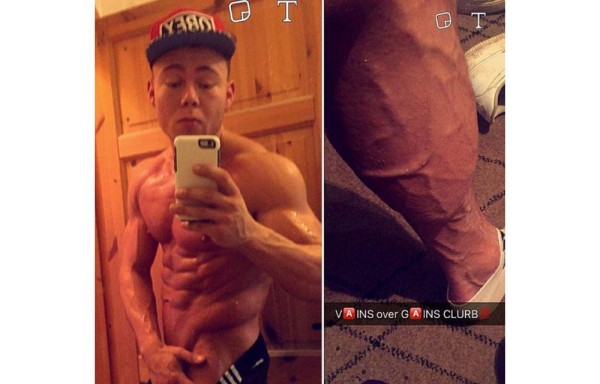 “Bullying” lo llevó al modelaje