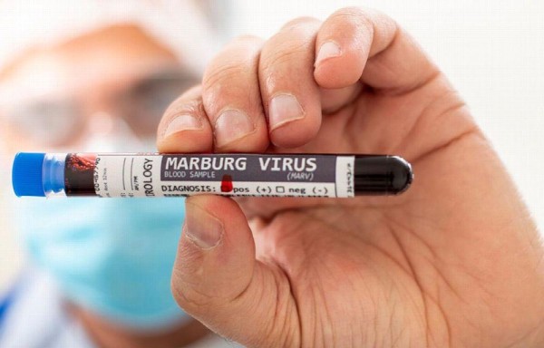 Ghana declara su primer brote de la enfermedad por el virus de Marburgo