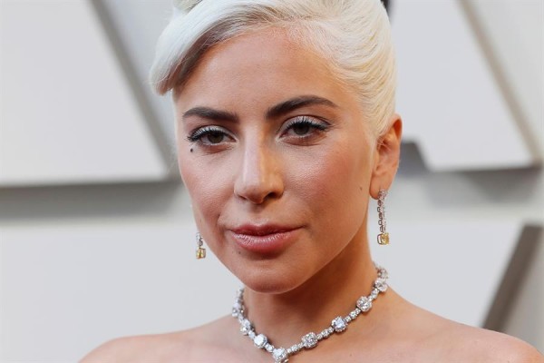 Lady Gaga recupera ilesos a los dos perros que le habían robado
