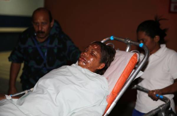 La potasa al tocar la piel produce quemaduras.