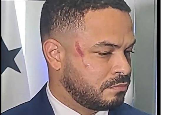 Richards acudió hoy al Ministerio Público para presentar una demanda contra Salazar.