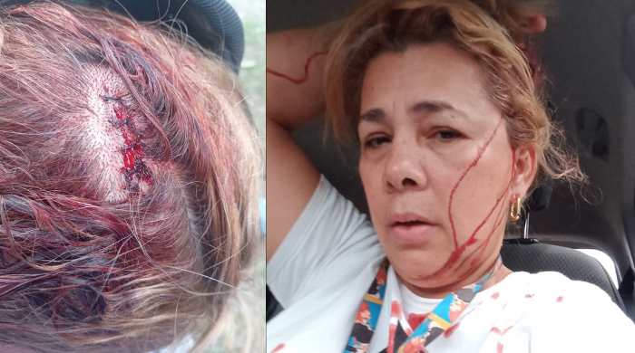 Tensión en Bocas: Atacan a directora encargada del INADEH con machete y piedras