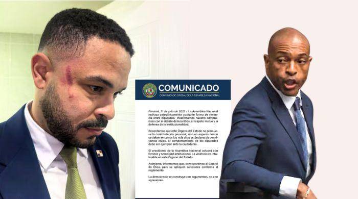 Betserai Richards quedó con un visible moretón en la parte derecha del rostro. Salazar es el señalado.