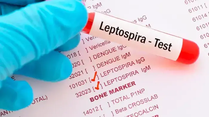 El Minsa también recomienda mantener una correcta higiene en la preparación de alimentos y prestar atención a cualquier síntoma sospechoso.