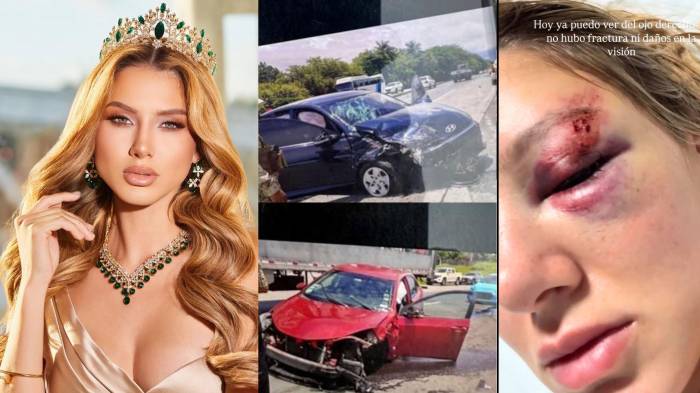¡Qué trancazo! Miss Costa Rica se accidentó en Panamá; está en recuperación