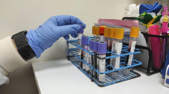 En el país existen métodos confiables para detectar el cáncer de próstata.