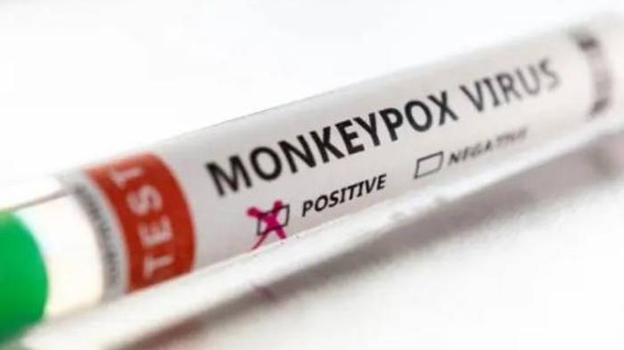 Minsa |Casos de Viruela Símica reaparecen en Panamá: Descubre los síntomas