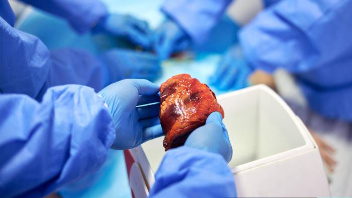 Trasplante de Órganos para ayudar a salvar vidas