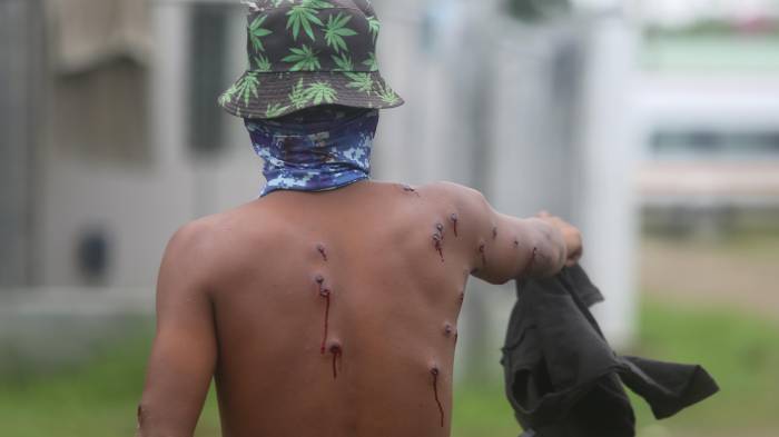 Fotografía de una persona con heridas en el cuerpo durante una protesta contra la reforma a la seguridad social este jueves, en Arimae (Panamá).
