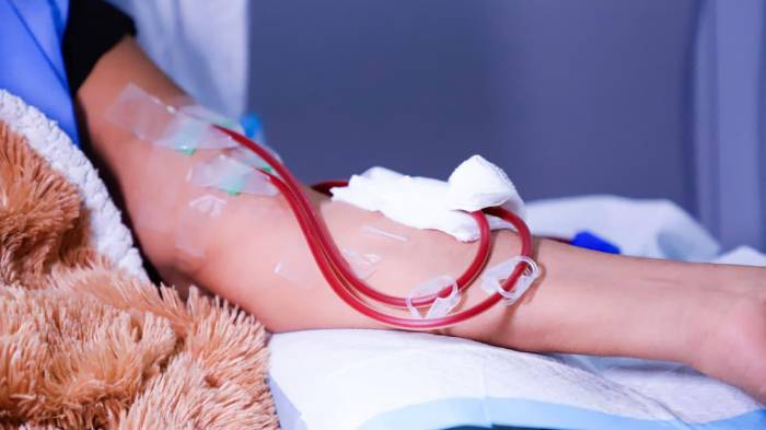 Diariamente se atienden entre 12 y 16 pacientes del programa de diálisis peritoneal.