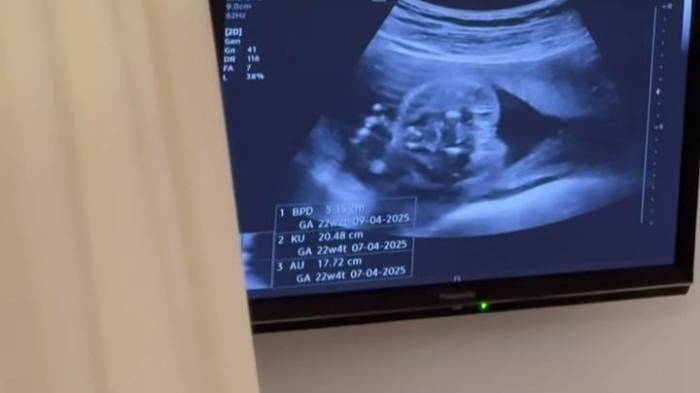 Sorpresa para Andrade y su esposa: Esperaban niño... pero es niña