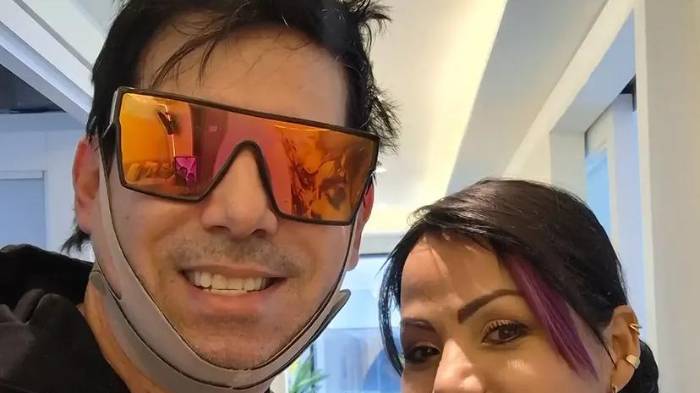 El líder de Los Rabanes se sometió a dos procedimientos estéticos para renovar su imagen.