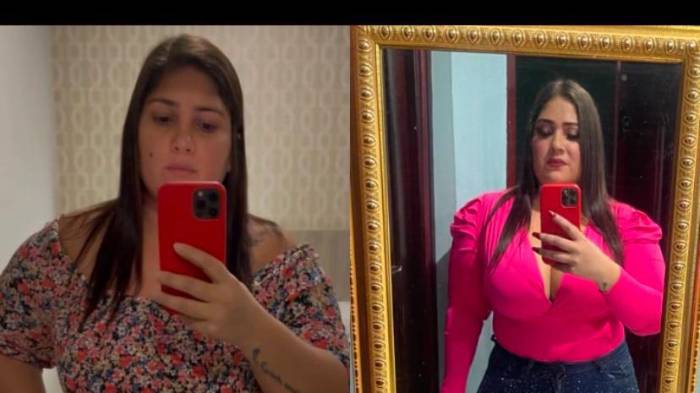 Cantante de música típica se somete a cirugía bariátrica y deslumbra con su transformación [Video]