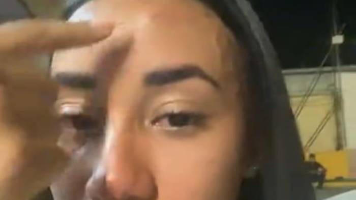 Representante de Tocumen resulta con chichón en la frente