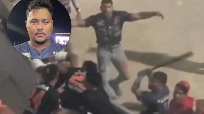 Juan José Aizprúa fue detenido por la Policía Nacional tras ser señalado como el pelotero que golpeó con un bate a Yeison Austin durante la trifulca.