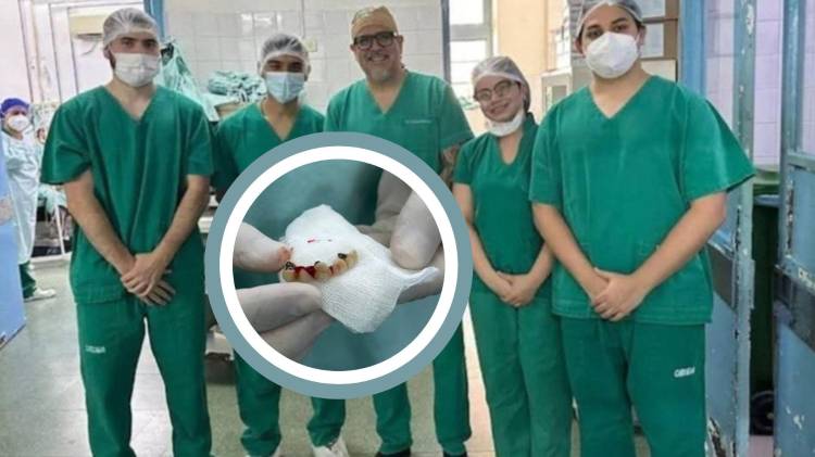 Perdió la chapa dental y los médicos la hallaron en un pulmón