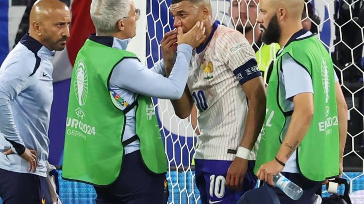 Mbappé se rompe la nariz, pero no será operado