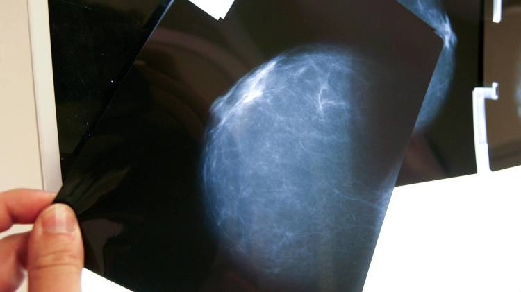 Prueba radiológica en Bilbao (España).