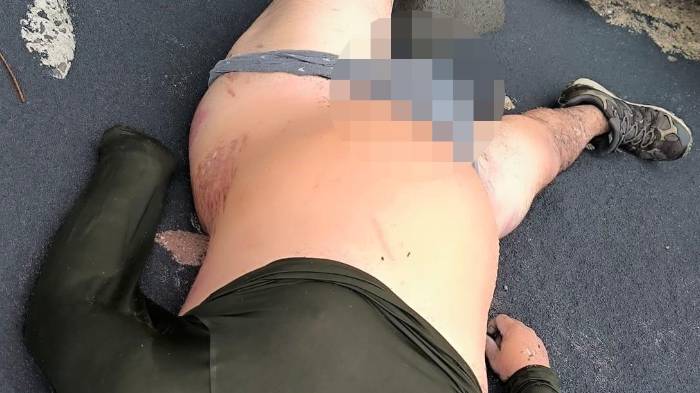 San Carlos | Hallan hombre muerto y 35 paquetes de drogas