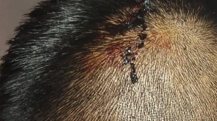 El policía herido fue atendido en un hospital de la localidad y le cosieron la herida