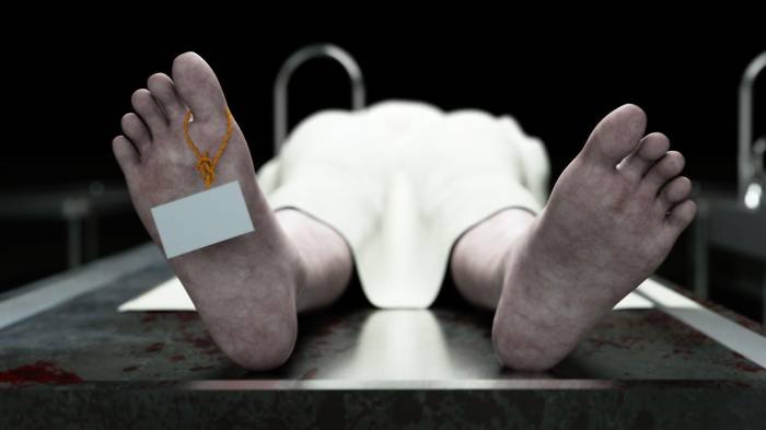 cadaver, dead male body in morgue on steel table. Corpse. Autopsy concept. 3d rendering.